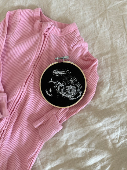 Hand Embroidered Ultrasound