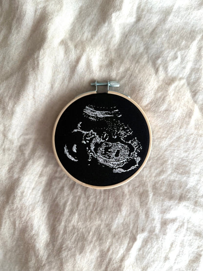 Hand Embroidered Ultrasound
