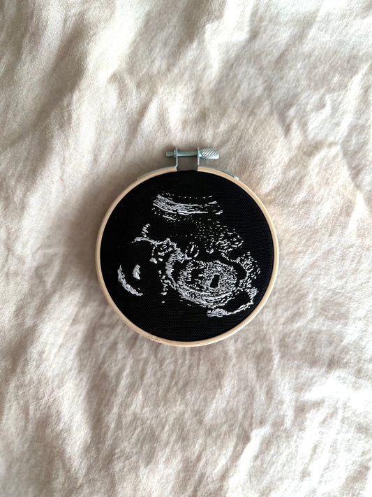Hand Embroidered Ultrasound