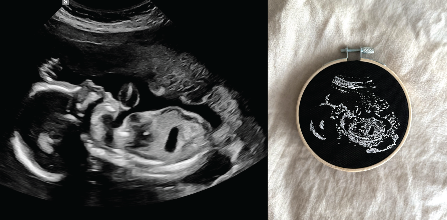 Hand Embroidered Ultrasound