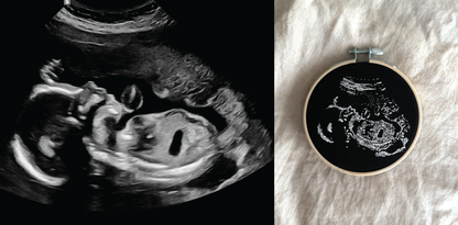 Hand Embroidered Ultrasound